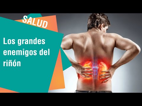 Salud | Conozca cuáles son los grandes enemigos del riñón