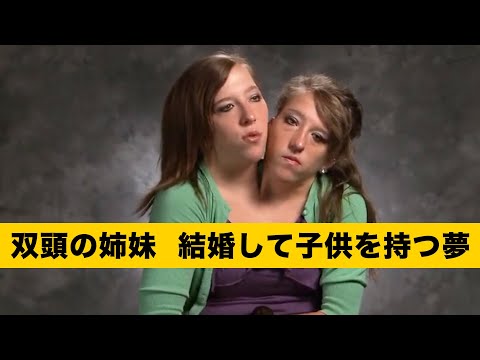 【結合双生児】双頭の姉妹は、1つの体を2人で制御していて、2つの心臓で心は通じ合っている