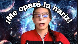 !Me operé la nariz! 👃🏻 Grabe día a día 🤯 mi experencia✨