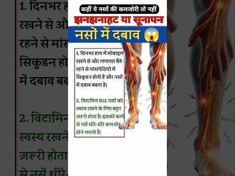 नस क्यूँ दब जाती हैं? 😱😭🔥 #viralvideo #viralshorts #physiodrdeepaksoni #sciatica