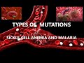 Gene Mutations and Sickle Cell Anemia