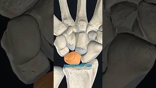 1/3 What Is Kienböck’s Disease?