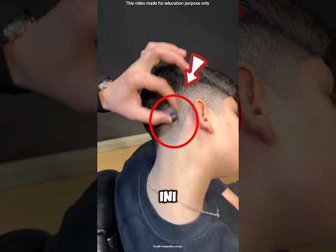 muncul benjolan aneh saat mencukur rambut!#shortvideo