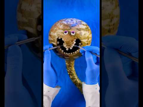 Emergency #FruitSurgery - Sus Avocado ate #MrKiwi! #DiacountDentist Ep 187 #Shorts