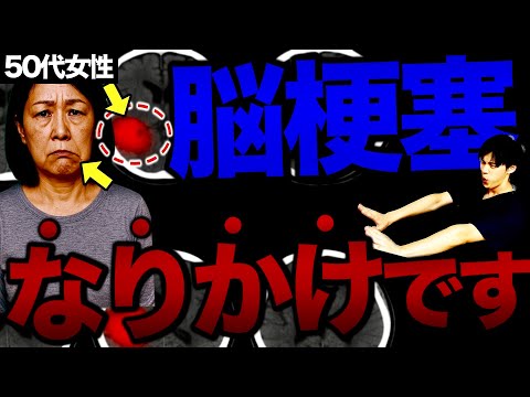 7月から脳梗塞が急増!!クレアチニン1.0以上は本当に危険？夏の脳梗塞を防ぐ簡単な方法