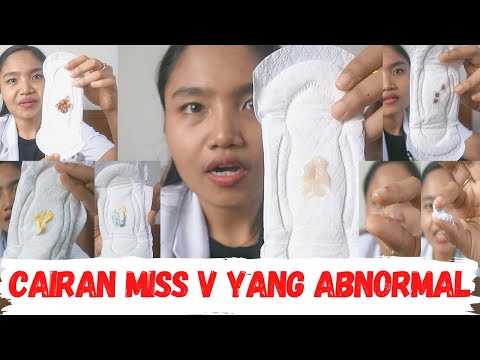 Cairan Keputihan Vagina Wanita yang Abnormal | dr. Emasuperr
