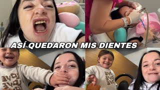 MIS NUEVOS DIENTES + AMELÍE ESTÁ ENORME!😍
