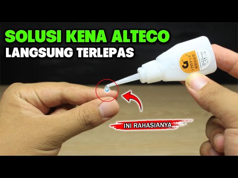 Ternyata Semudah ini, Cara Melepaskan Kulit Jari Kena ALTECO Lem G Super Glue