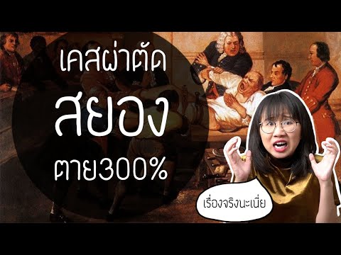 ผ่าตัดสยอง โอกาสตาย 300% : วิธีรักษาสุดสยองในประวัติศาสตร์ EP. 2 | Point of View