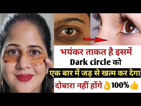 You tube पर dark circle को ठीक करने की भयंकर दवाई किसी ने नहीं बताई होगी दोबारा नहीं.#darkcircle