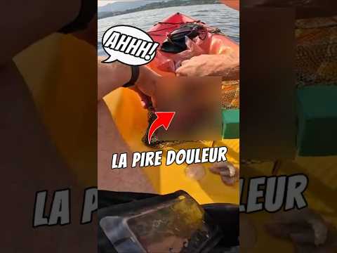 La pire douleur de ma vie : mon expérience de la piqûre d'un chapon. Je l'ai bien racontée ?