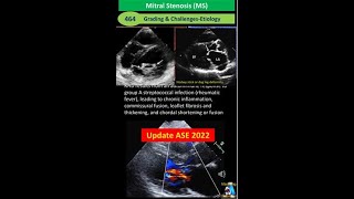 Mitral Stenosis (MS): Grading & Challenges; Update ASE 2022