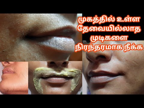 முகத்தில் உள்ள தேவையற்ற முடிகளை நீக்க இந்த 3 பொருள் போதும் /How To remove Unwanted hair permanently