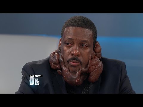 Surprises for Man Covered in Keloids