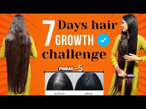 Day-5 |  7 days hair growth challenge | hair growth transformation अब आपके भी बाल होगे मजबूत #hair