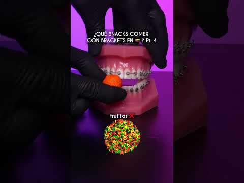 ¿Qué comer con Brackets en ??? Pt. 4 Odontología Láser #shorts