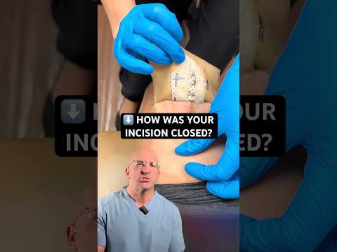 Closing Your Incision: Staples, Stitches or Ziptie?  #shorts