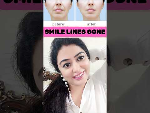 #smilelines #nasolabialfolds #laughtlines #droopylips #lipsagging #faceyoga #faceyogaexercises