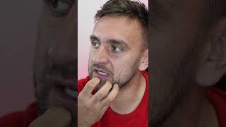 Od kolika let se smí koupit los?