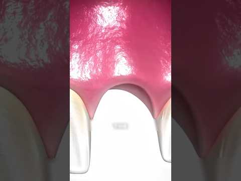 Если вы видите, как кто-то теряет зуб, немедленно бегите!