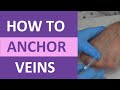 Vein Anchoring Techniques and Safety