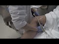 Understanding Blood Clots and Prevention