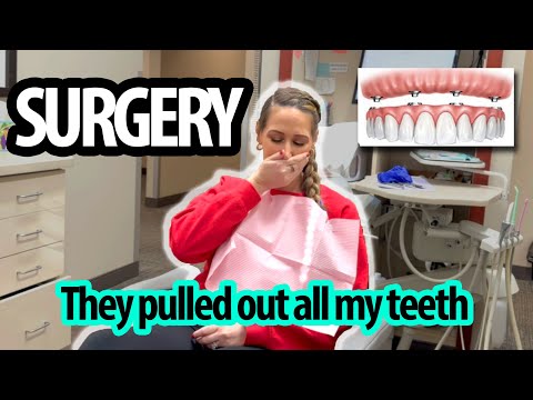 🤕SURGERY - WARNING: graphic content - ALL ON 4 DENTAL IMPLANTS