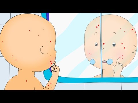 Caillou en Español Castellano | Caillou con Varicela | Dibujos Animados Capítulos Completos