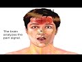 Understanding Pain Mechanisms