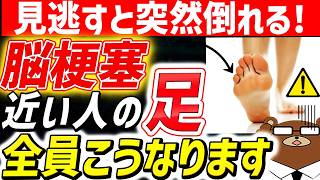 放置厳禁！知らないと後悔する脳梗塞の「足」の初期症状。こんなしびれ、ふらつきは要注意。絶対に見逃してはいけない膝の兆候とは？異変が出たら最初にすべきことは？脳梗塞を未然に防ぐ方法とは。医師が徹底解説！