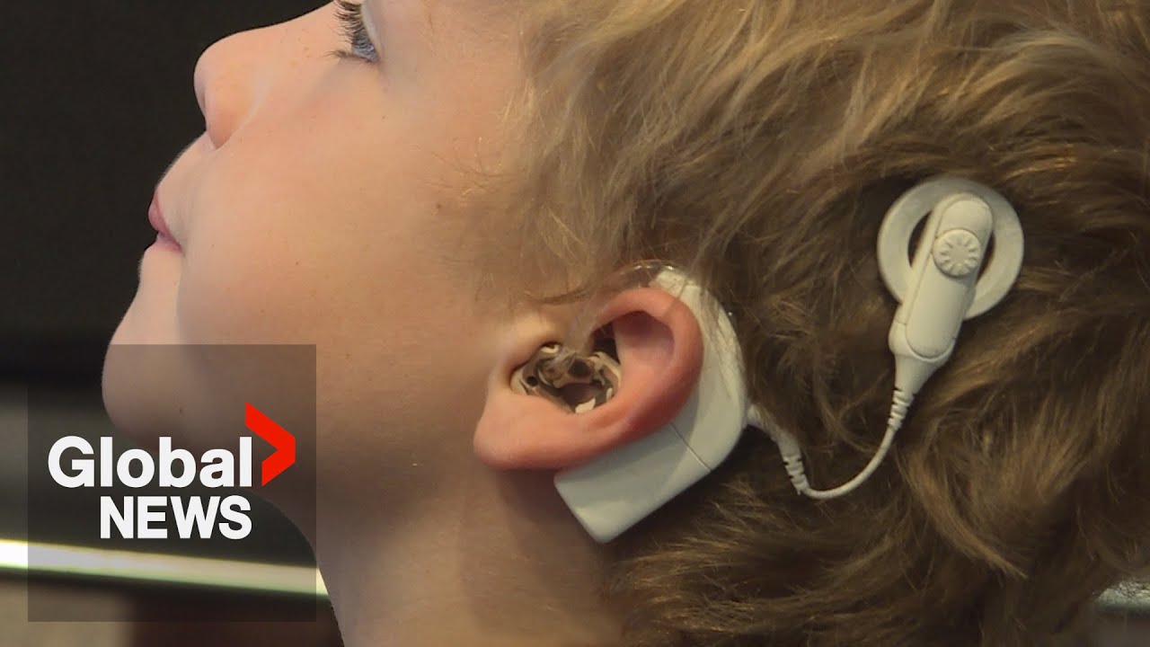 “Hearing shouldn’t be for the privileged”: Ontario family fights for cochlear implant coverage