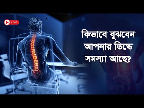 কিভাবে বুঝবেন আপনার ডিস্কে সমস্যা আছে?