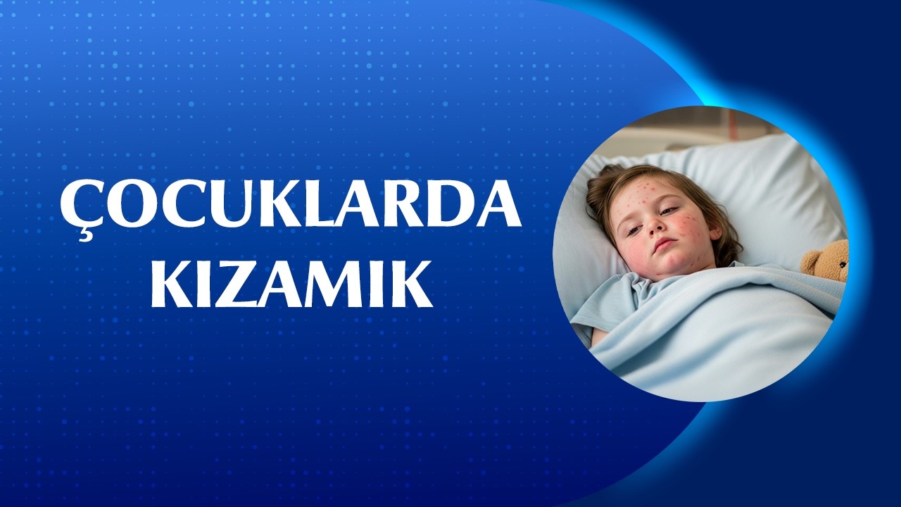 Çocuklarda Kızamık Belirtileri Nelerdir? Nasıl Bulaşır? Kaç Gün Bulaşıcıdır?