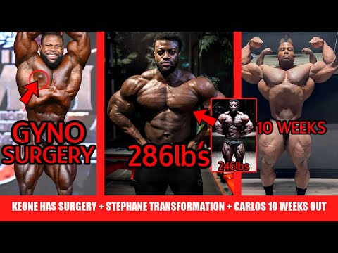 Keone Has Gyno Surgery + INSANE Classic Physique to Open BB Transformation + Carlos Thomas Jr Update