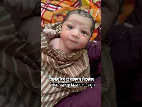 কিউট বেবি অপারেশন থিয়েটার থেকে বের হয়েস সবাই কে অবাক করে দিলো #famousbabyworld #newbornbaby #cute