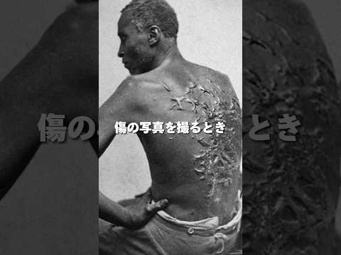 鞭に打たれた黒人奴隷の実際の傷跡に #歴史 #世界史 #黒人奴隷