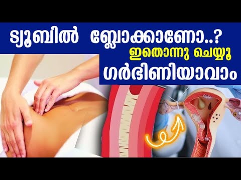 ഫലോപ്പിയന്‍ ട്യൂബിലെ ബ്ലോക്ക്  നീങ്ങി പോകാനും ഗര്‍ഭിണിയാവാനും, Blocked Fallopian Tubes home remedies