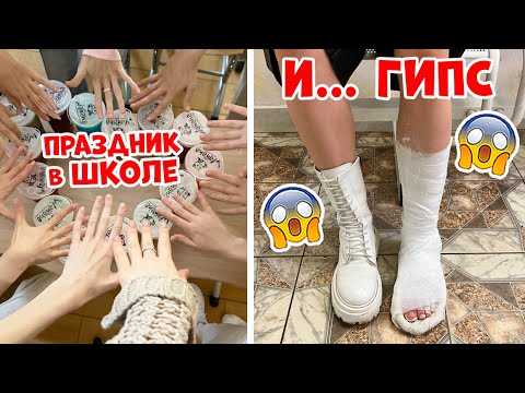 СЛОМАЛА НОГУ под Новый Год... ТРЕШ девАчки 😱