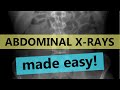 Abdominal X-ray Interpretation Concepts