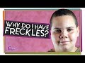Understanding Freckles and Melanin