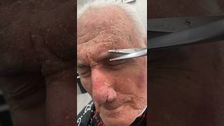 ASMR: Dry Scalp Impact on his Face