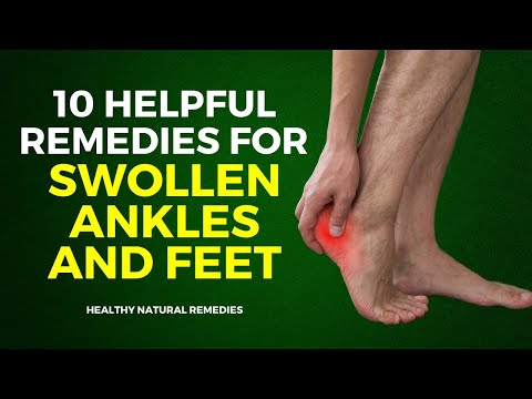 10 Helpful Remedies For Swollen Ankles And Feet