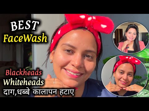 Best Face Wash कौन सा है ? For All Skin Types, Blackheads/Whiteheads/Dark Spots ? पाएं चमकदार त्वचा💖