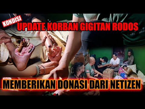 UPDATE SI BAIM KORBAN GIGITAN RODOS/RANJAU DARAT/GIBUG | MEMBERIKAN DONASI DARI NETIZEN