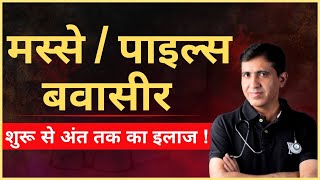 Bawasir / Piles / Masse ka Ilaaj | पाइल्स का शुरुआत से अंत तक का आसान इलाज