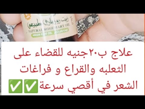 مش هتصدقي نفسك من اطالة شعرك وكثافتخ بجنون