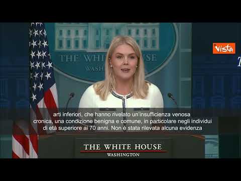 La Casa Bianca: "Trump ha insufficienza venosa cronica alle gambe" - ITALIANO