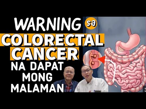 Warning sa Colorectal Cancer na Dapat Mong Malaman