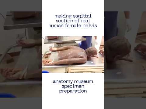 Cutting the human body into sections, sagittal section of female pelvis, anatomy museum #shorts