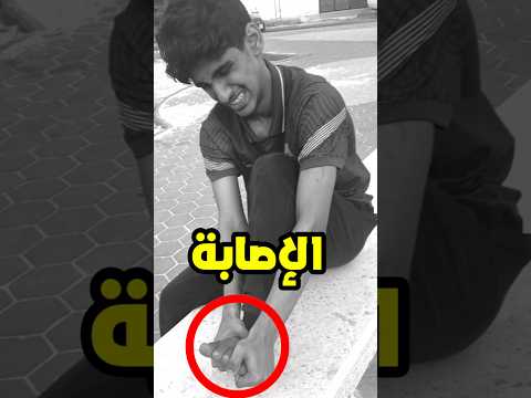 وأخيرًا لعبت كورة بعد الإصابة 🤕 #shorts